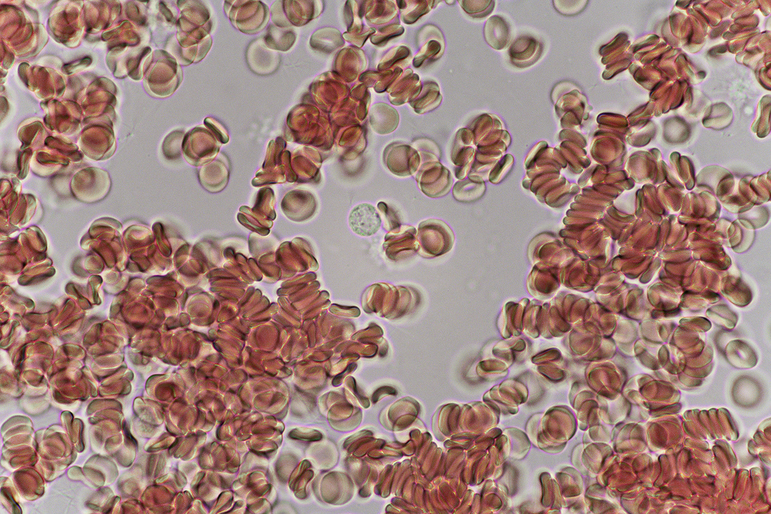 expanded photography